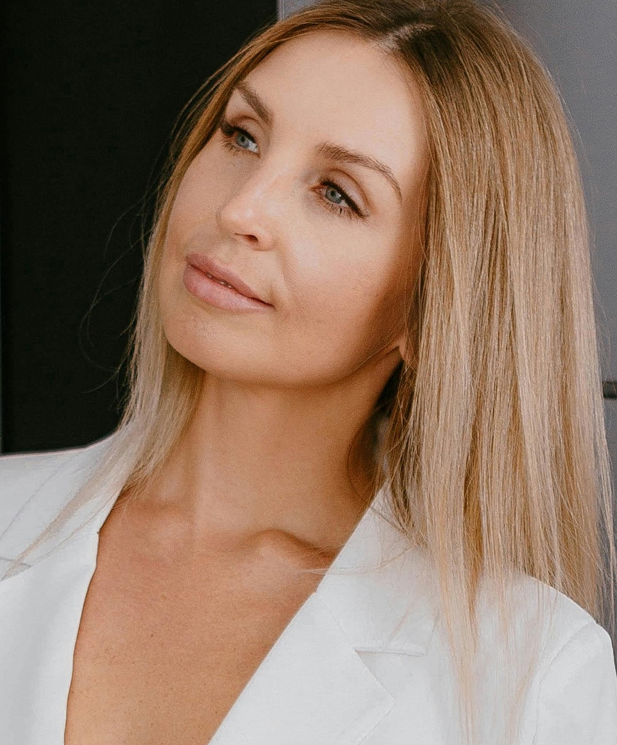 St. Louis IPL Photofacial model with long hair, thoughtful expression.