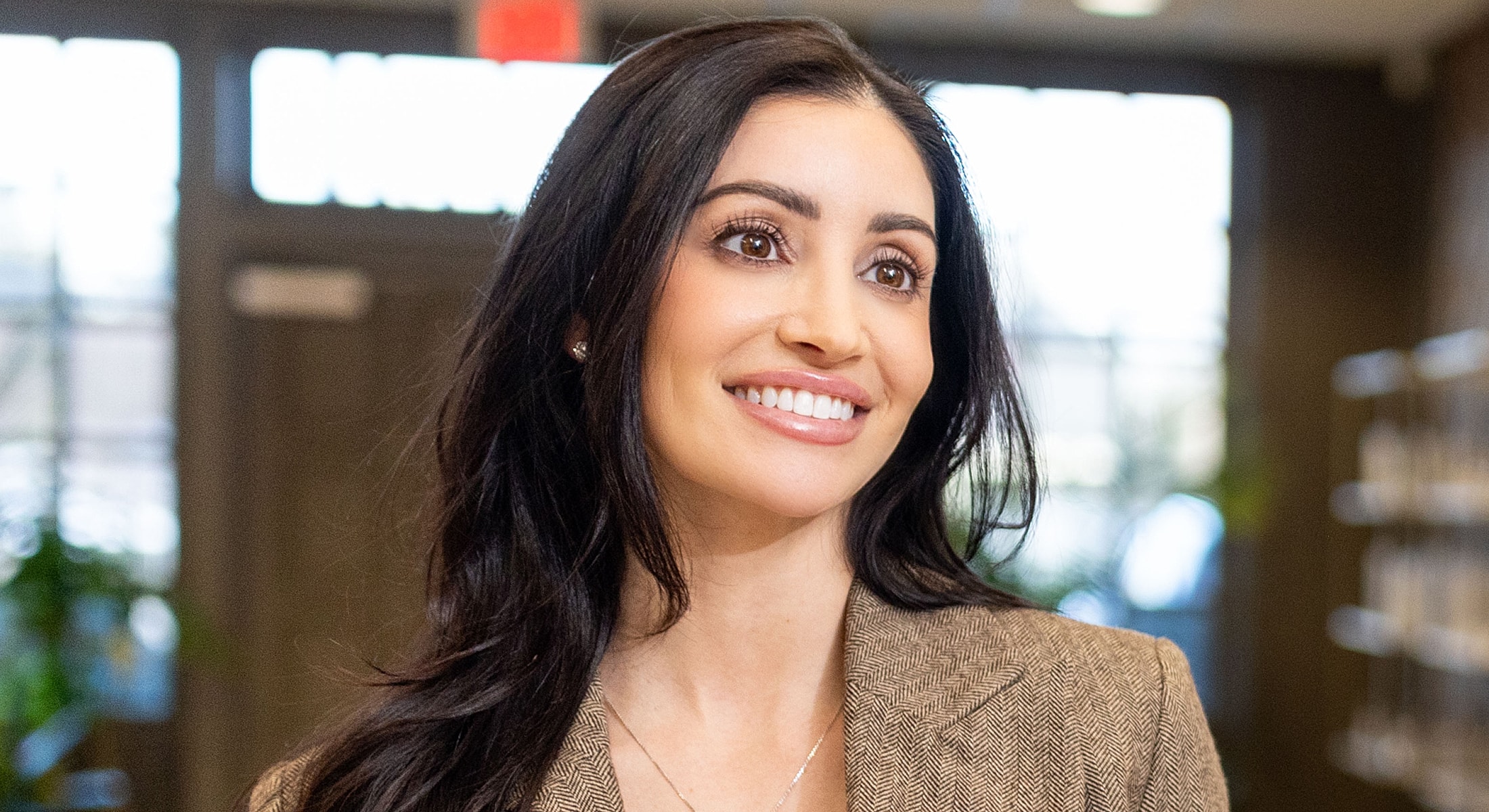 St. Louis Lip Filler model in a business setting.